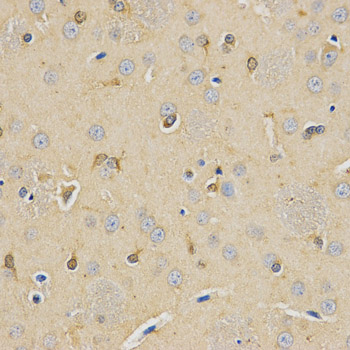 CPE Antibody (OAAN01296) in Rat Brain using Immunohistochemistry