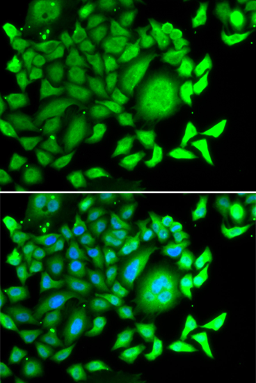 CD47 Antibody (OAAN02197) in MCF7 Cells using Immunofluorescence