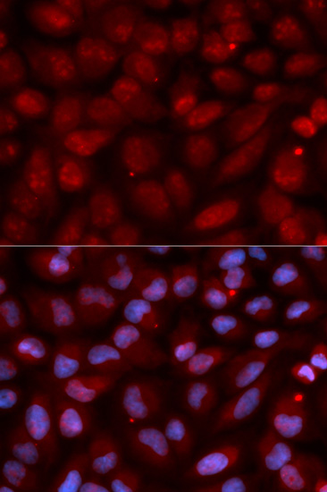 CD47 Antibody (OAAN00562) in U20S Cells using Immunofluorescence
