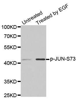 JUN Antibody (Phospho-Ser73) (OAAN02763) in PC14 Cells using Western Blot