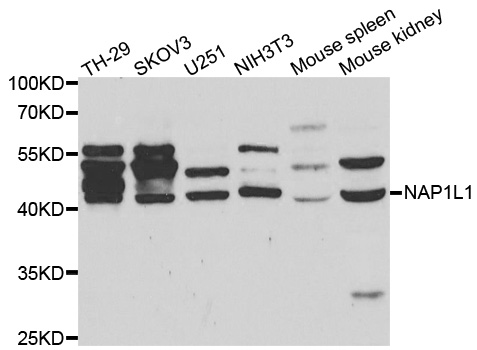 NAP1L1 Antibody (OAAN00957) in Multiple Cell Lines using Western Blot