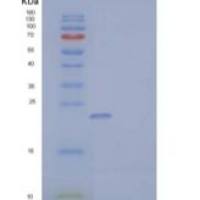 小鼠NKG2D配体1/NKG2DL/ULBP1重组蛋白C-6His