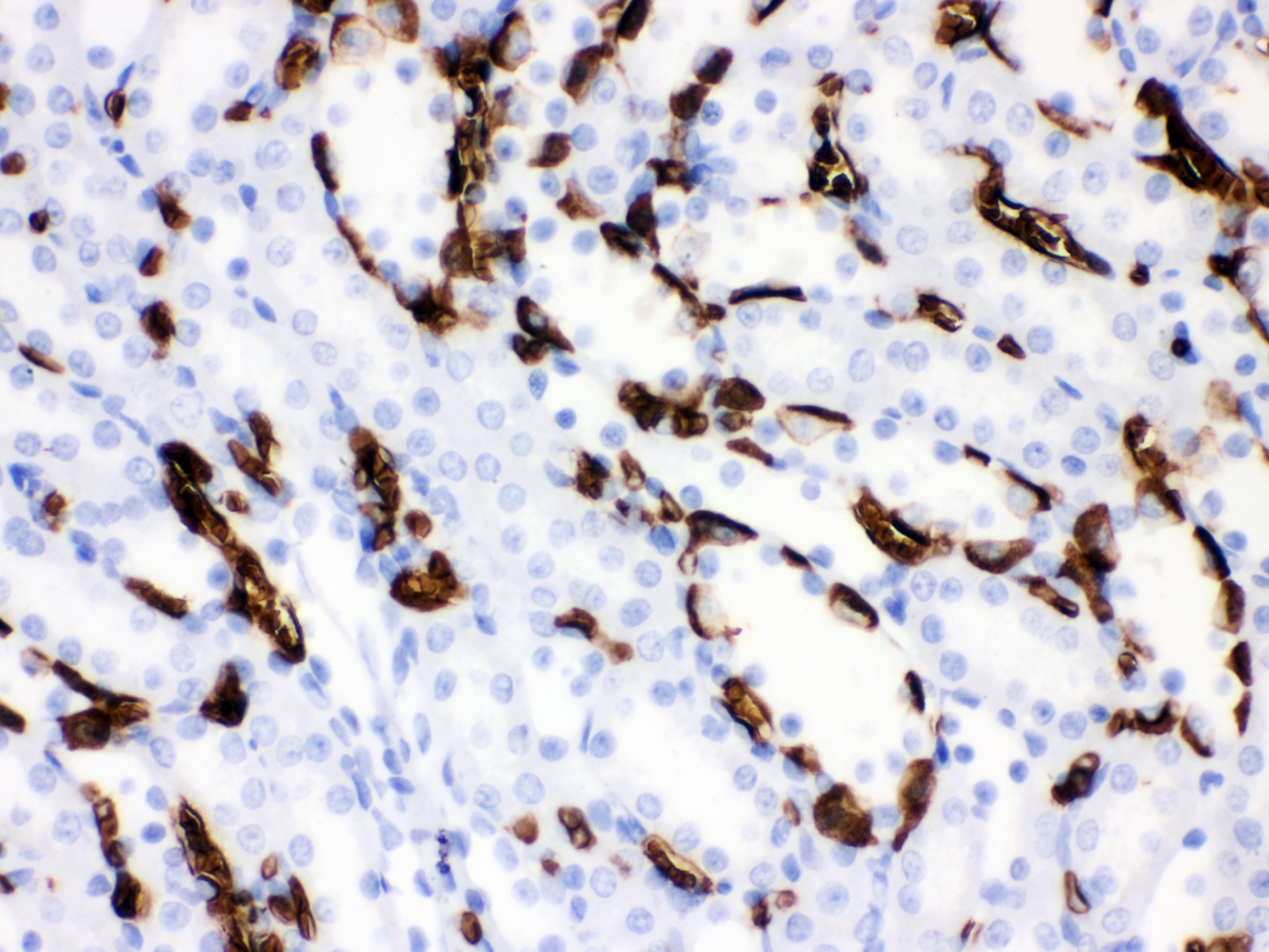 BAND 3 Antibody (OABB01920) in Rat Kidney Tissue using Immunohistochemistry