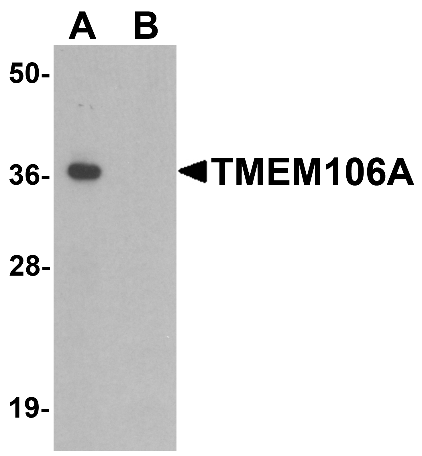 TMEM106A Antibody - N-terminal (OAPB01561) in A-20 cell lysate using Western Blot