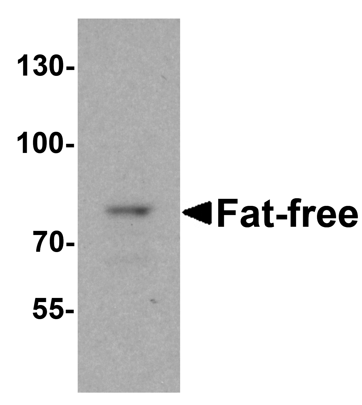 Fat Free Antibody - C-terminal (OAPB01626) in Brain tissue lysate using Western Blot