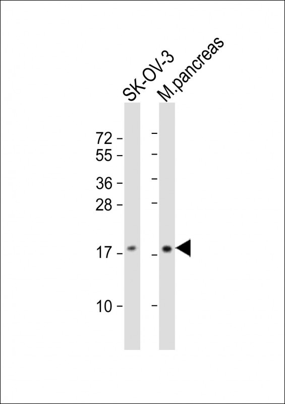 TMF1 Antibody - middle region (OAAB22201) in SK-OV-3 Cells, Mouse Pancreas Cells using Western Blot