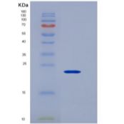 人CD147 / EMMPRIN / Basigin重组蛋白His tag