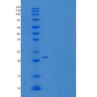人BH3-相互作用结构域死亡激动剂重组蛋白