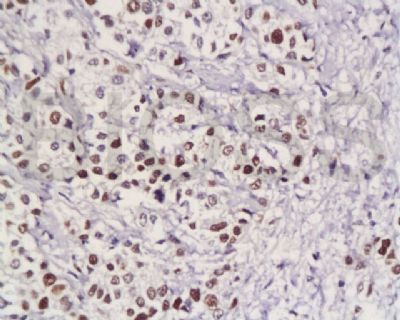 扑克蒙蛋白抗体