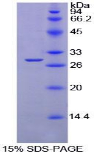 PTPRS Recombinant Protein (OPCD06532) using SDS-PAGE
