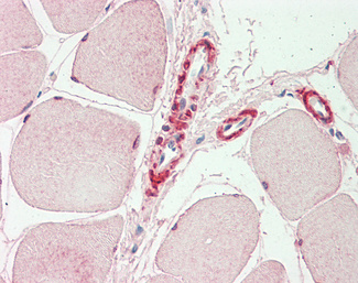 INPP5K Antibody (OALA07803) in Human Skeletal Muscle using ELISA