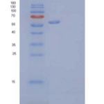 人肝配蛋白A型受体4重组蛋白