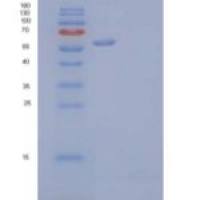 人肝配蛋白A型受体4重组蛋白