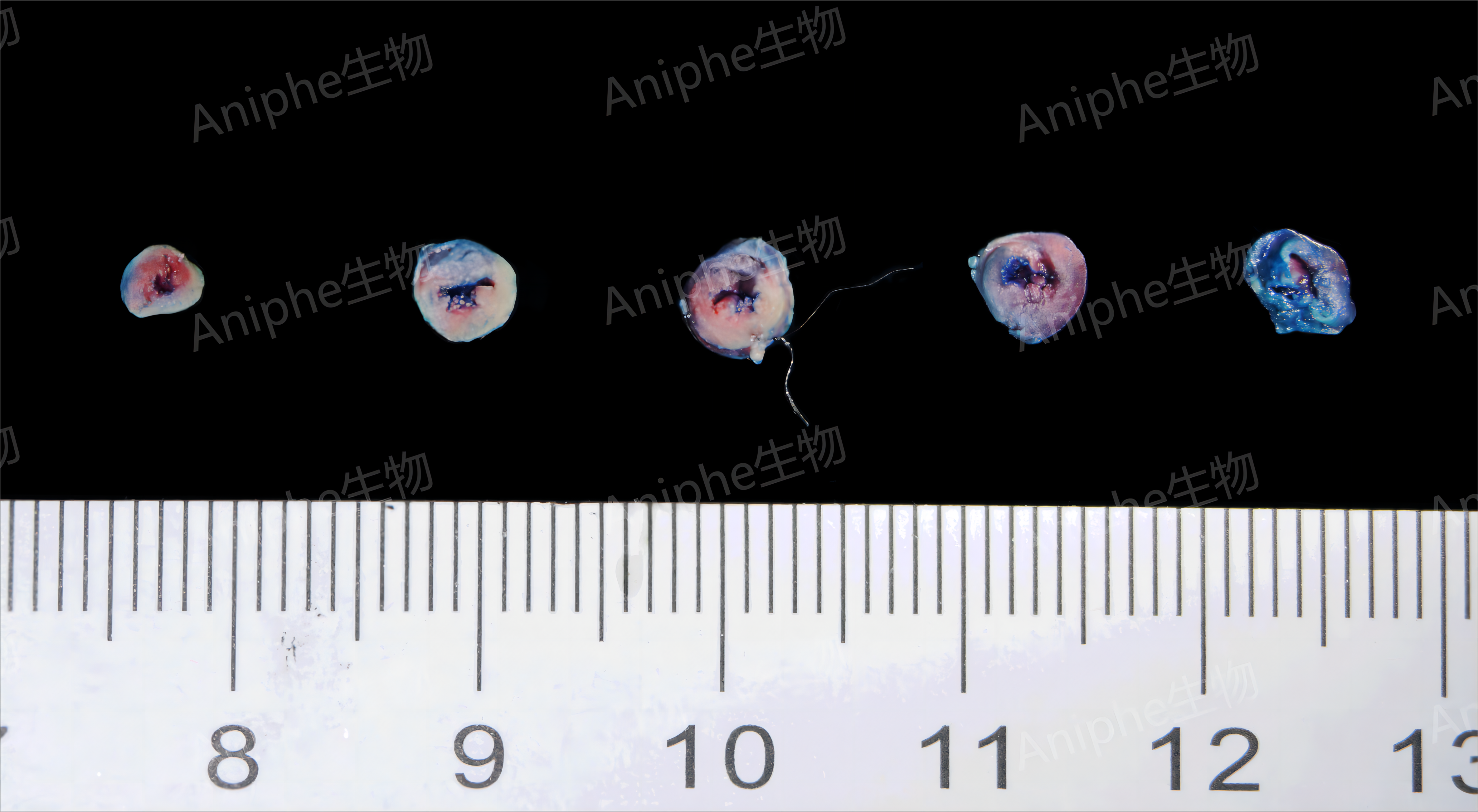 【免费检测超声】心肌梗死(MI)小鼠模型 MI模型 心梗模型