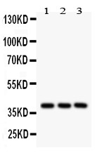 PTGER2 Antibody - C-terminal region (OABB01869) in Human Placenta Tissue Lysate, A549 Whole Cell Lysate, HEPG2 Whole Cell Lysate using Western Blot