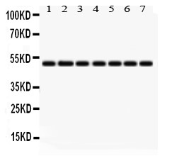 IDH2 Antibody - C-terminal region (OABB02085) in Rat Cardiac Muscle Tissue Lysate, Rat Liver Tissue Lysate, NIH3T3 Whole Cell Lysate, SW620 Whole Cell Lysate, HELA Whole Cell Lysate, MCF-7 Whole Cell Lysate, 22RV1 Whole Cell Lysate using Western Blot