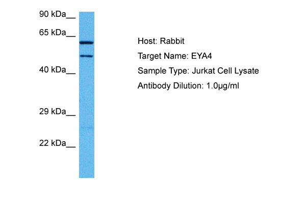 EYA4 Antibody - middle region (ARP81512_P050) in Human Jurkat Whole Cell using Western Blot