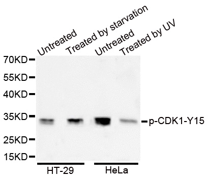 CDK1 Antibody (Phospho-Tyr15) (OAAN02725) in HeLa Cells using Western Blot