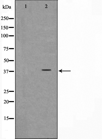 NT5C3A Antibody (OAAJ02036) in Jurkat cell lysate using Western Blot