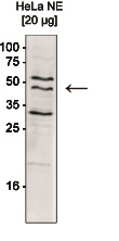 WDR5 Antibody (OADC00246) in Human Hela cells using Western Blot
