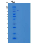 人脑特异性血管生长抑制因子3(BAI3)重组蛋白C-6His
