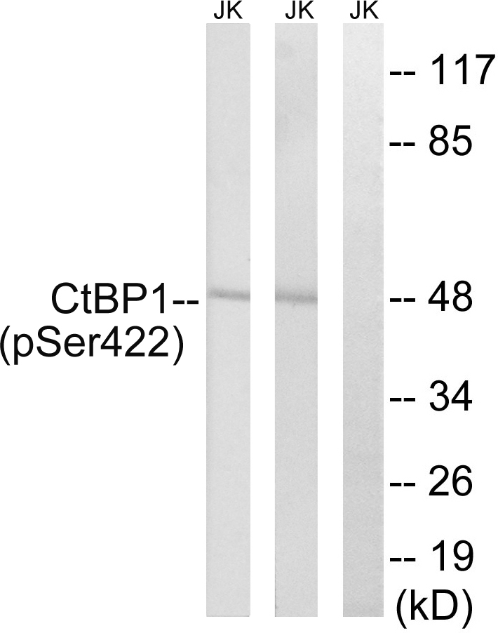 CTBP1 Antibody (Phospho-Ser422) (OAAB20222) in Human Jurkat Cells using Western Blot
