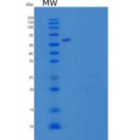 人富含纤维连接蛋白亮氨酸跨膜蛋白2重组蛋白