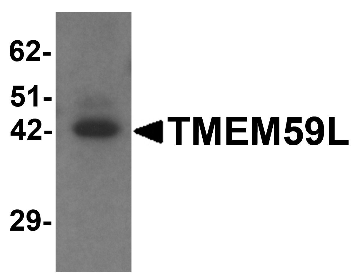 TMEM59L Antibody - C-terminal (OAPB01456) in Heart tissue lysate using Western Blot