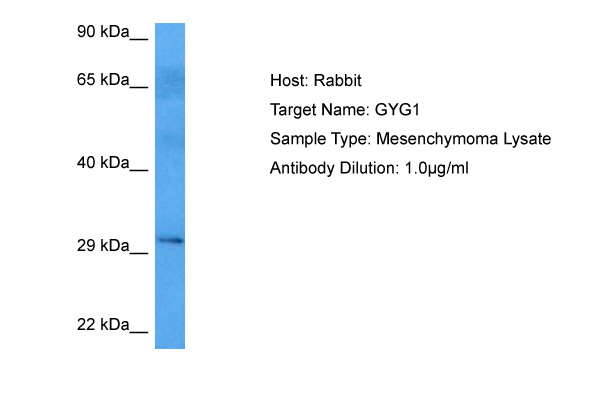 GYG1 Antibody - middle region (ARP78428_P050) in Human Mesenchymoma using Western Blot