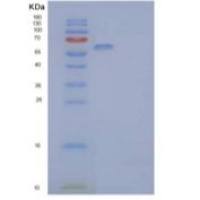 人白细胞介素1受体样2/白细胞介素1受体2重组蛋白C-Fc