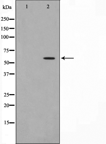 HBP1 Antibody (Phospho-Ser402) (OAAJ01671) in A549 cell lysate using Western Blot