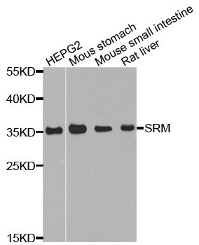 SRM Antibody (OAAN02620) in Multiple Cell Types using Western Blot