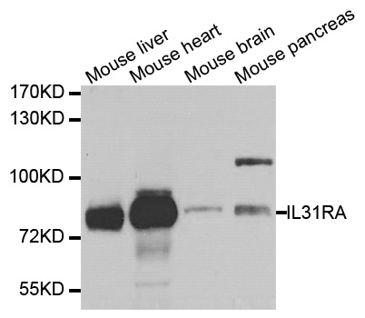 IL31RA Antibody (OAAN01632) in Multiple Cell Lines using Western Blot