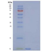 大鼠C-C基序趋化因子5重组蛋白