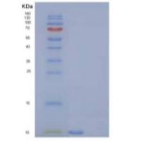 大鼠C-C基序趋化因子5重组蛋白