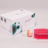 L5178Y TK+/- clone(3.7.2C)（小鼠淋巴瘤细胞）