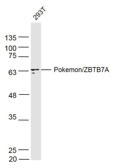 扑克蒙蛋白抗体