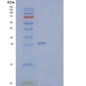人CMRF35样分子9重组蛋白
