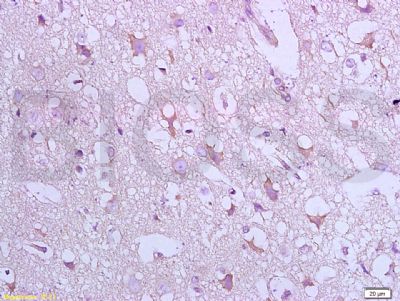 Bax抗体文献引用