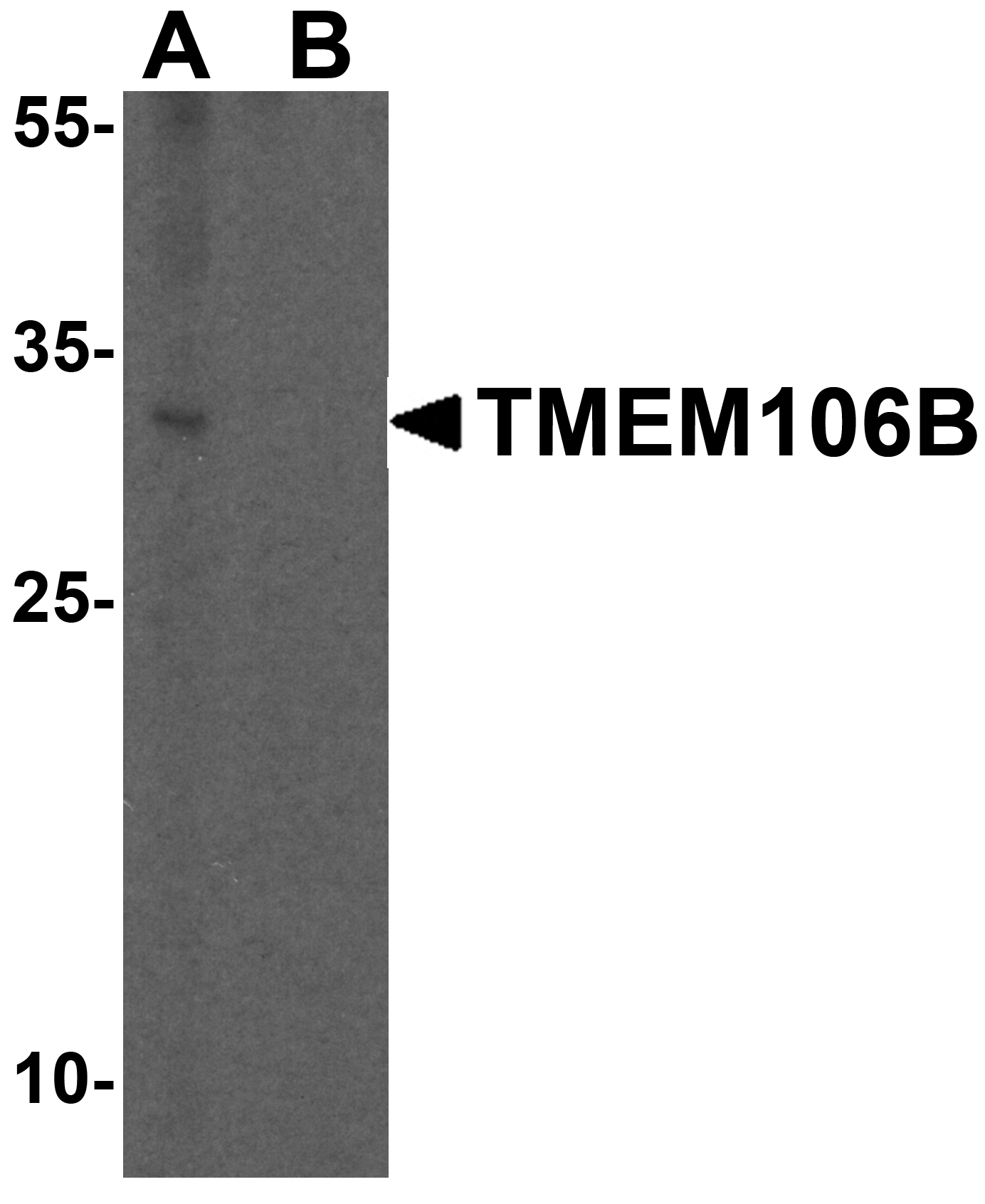 TMEM106B Antibody - N-terminal (OAPB01562) in Brain tissue lysate using Western Blot