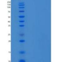 人防御素β2(DEFb2)重组蛋白