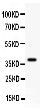 DICER1 Antibody (OABB00929) in Recombinant Human Dicer Protein using Western Blot