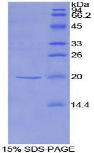 NME1 Recombinant Protein (OPCD05683) using SDS-PAGE