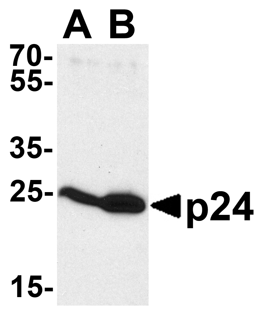 HIV-1 p24 Antibody (OAPB01749) in Recombinant HIV-1 p24. using Western Blot