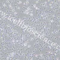 C643、C643细胞、C-643细胞、C-643、人甲状腺癌细胞/STR鉴定/镜像绮点（Cellverse）