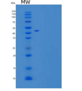小鼠卷曲同源物2(FZD2)重组蛋白C-Fc