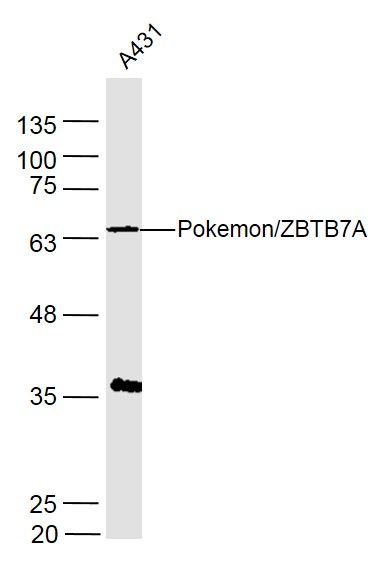 扑克蒙蛋白抗体