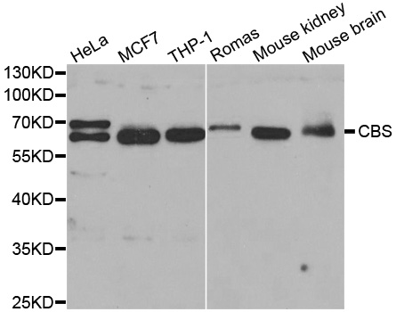 CBS Antibody (OAAN00347) in Multiple Cell Lines using Western Blot