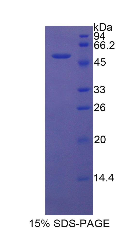 DKK1 Recombinant Protein (OPCD02746) using SDS-PAGE