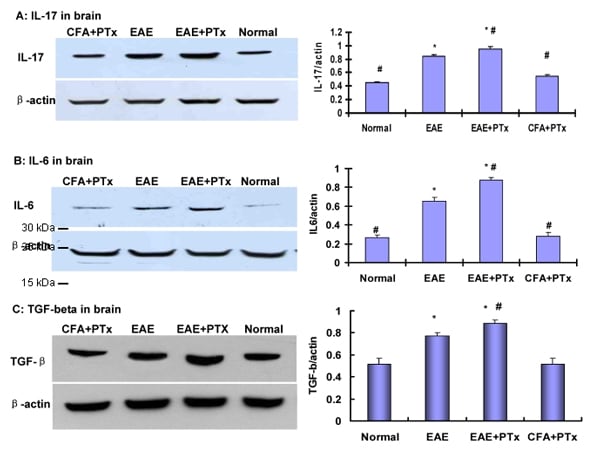 HRP Anti-beta Actin antibody [